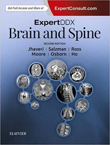 ExpertDDx مغز و ستون فقرات - رادیولوژی